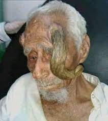 عن عمر 140 عاماً.. وفاة "ذو القرنين" اليمني