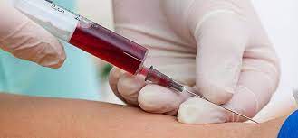 الداخلية تعلن الإستمرار بفحوصات ضباطها و منتسبيها لكشف تعاطي المخدرات