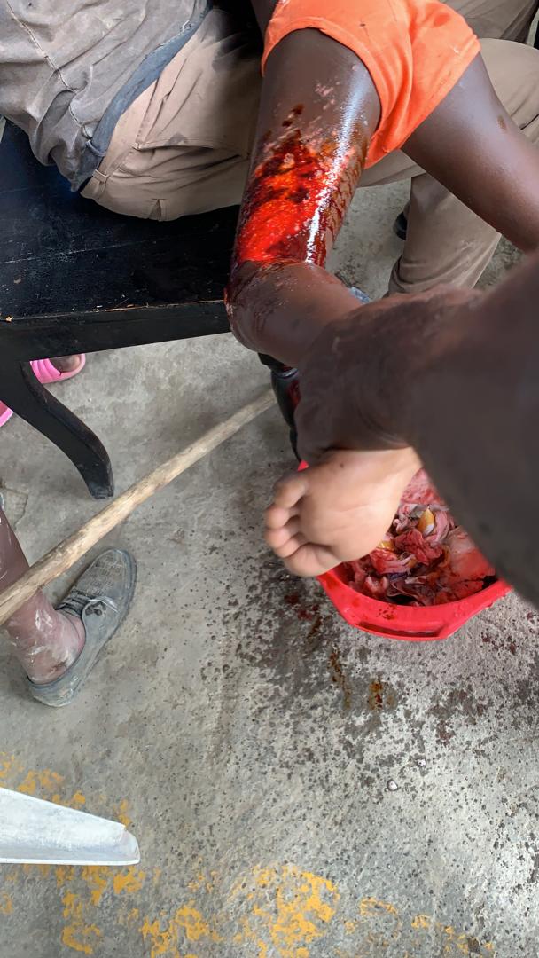 Hope Alive doctor and nurse treating boy rescued from being trapped under a building 8/19/21