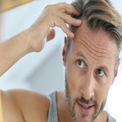 Hair Transplantation - Principles and Methods image