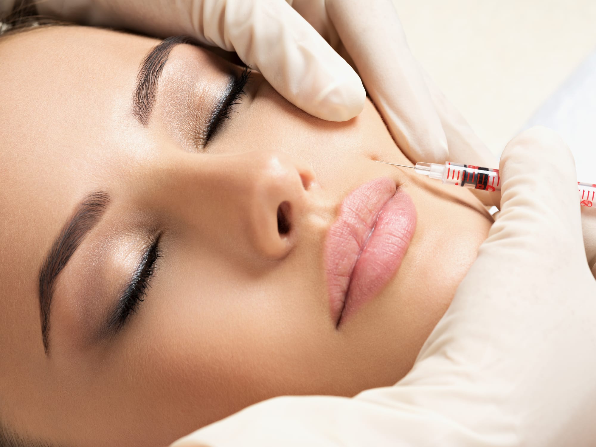 HARMONIZAÇÃO FACIAL (BOTOX, ÁCIDO HIALURÓNICO, FIOS, BIOESTIMULADORES)
