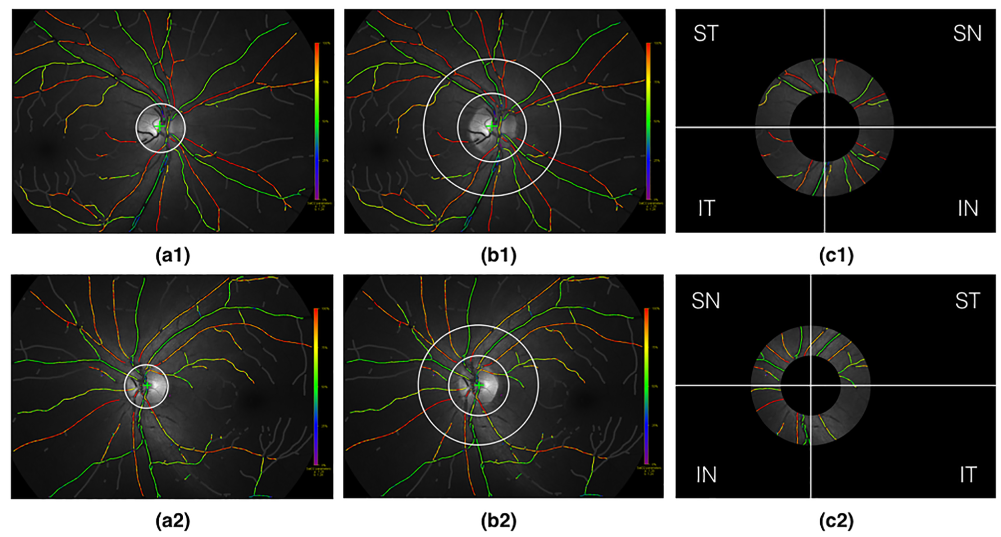 Automatic analysis of normative retinal oximetry images