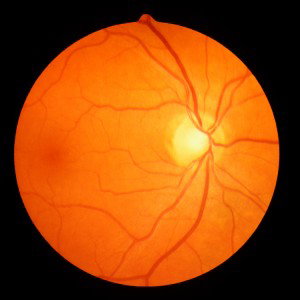 Rim-to-disc ratio outperforms cup-to-disc ratio for glaucoma prescreening