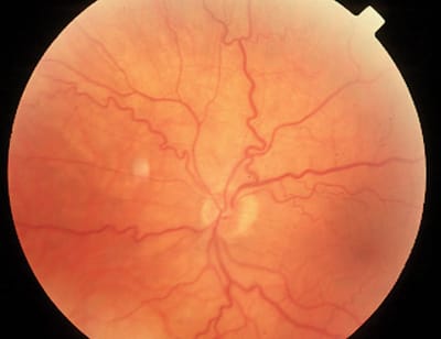 Automatic Classification of Artery/Vein from Single Wavelength Fundus Images
