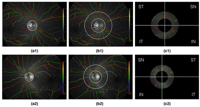 Automatic analysis of normative retinal oximetry images