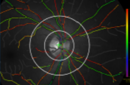 Retinal Oxygen Saturation Estimation