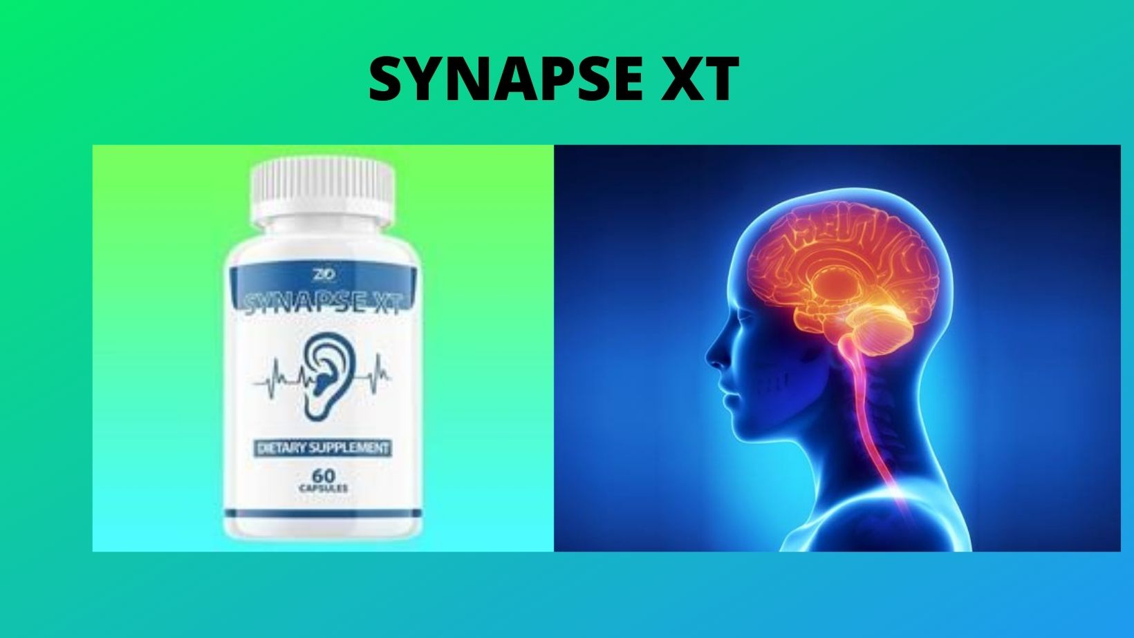 Synapse XT- Are A Permanent Tinnitus Cure Formula?