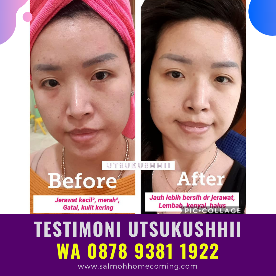 Manfaat Utsukushii AFC, WA 0878 9381 1922