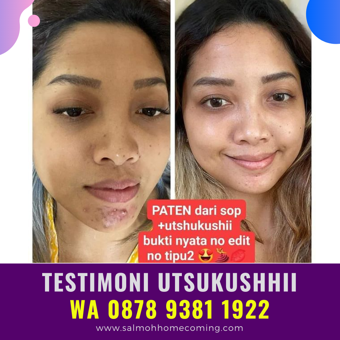 Utsukushii Untuk Umur Berapa, WA 0878 9381 1922