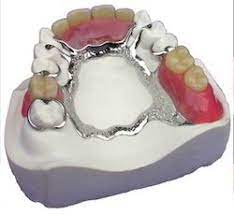 Prosthodontics