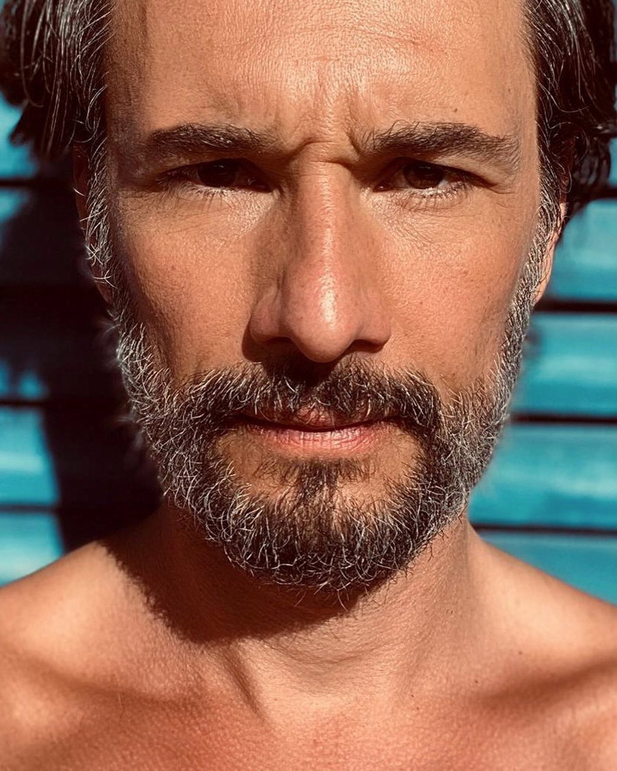 RODRIGO SANTORO DUBLA SOFRIDO COELHO COBAIA NA CAMPANHA GLOBAL PELA PROIBIÇÃO DO TESTE DE COSMÉTICOS EM ANIMAIS