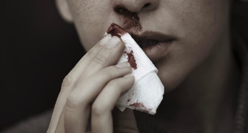 وفاة 70 شخصا هذا العام بحمى القرم -الكونغو في أفغانستان