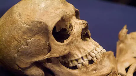 جماجم محطمة تكشف تطور العنف في المجتمعات البشرية المبكرة