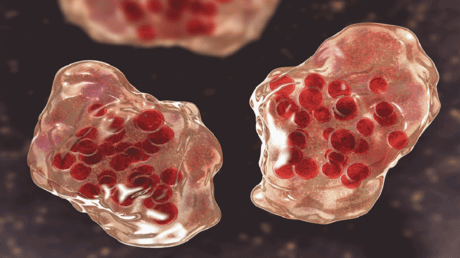 العلماء يحذرون من "وباء كبير" قد يكون "الأكثر فتكا" بتاريخ البشرية!