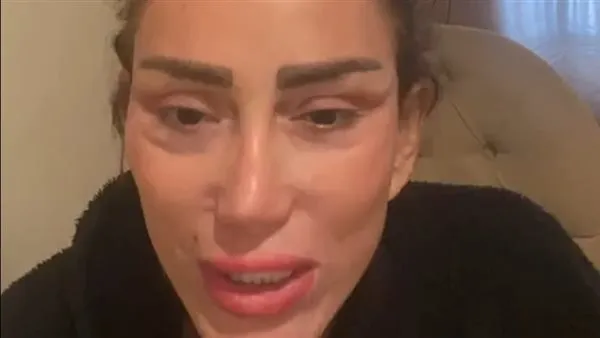 "مشغول بالموبايل في غرفة العمليات".. ريهام سعيد تفضح دكتور التجميل نادر صعب