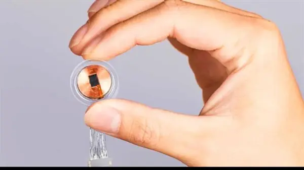 إنجاز القرن.. نجاح زراعة أول شريحة إلكترونية في أدمغة البشر