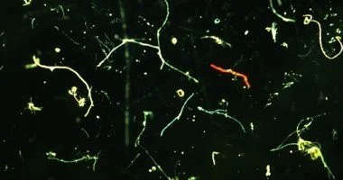 دراسة: المواد البلاستيكية الدقيقة تزيد من خطر الإصابة بنوبة قلبية