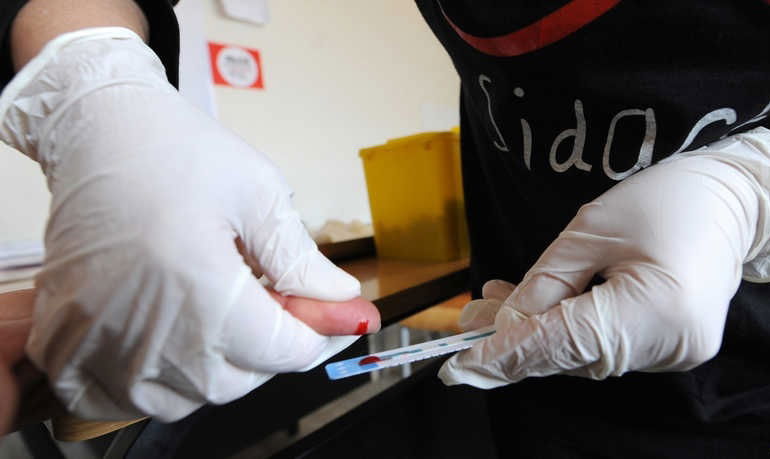 هل تفشى مرض الايدز بالعراق؟.. الصحة تطمئن: هي الأقل في العالم والمنطقة