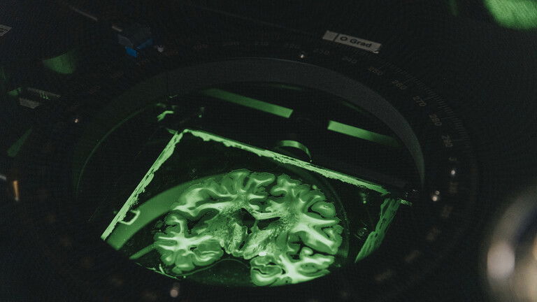 إنشاء أول دماغ صغير في العالم مزود بحاجز دموي دماغي وظيفي