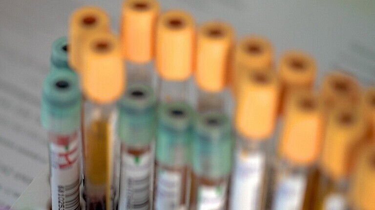 ابتكار مولد نانوي يستخرج الطاقة الكهربائية من دم الإنسان