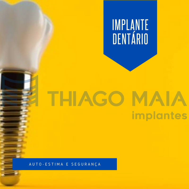 IMPLANTES DENTÁRIOS