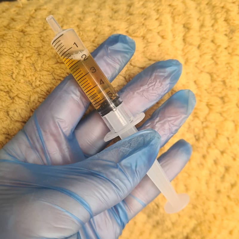 Platlet Rich Plasma -prp facial