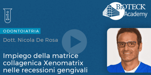 L’utilizzo della matrice collagenica tridimensionale Xenomatrix® nelle recessioni gengivali