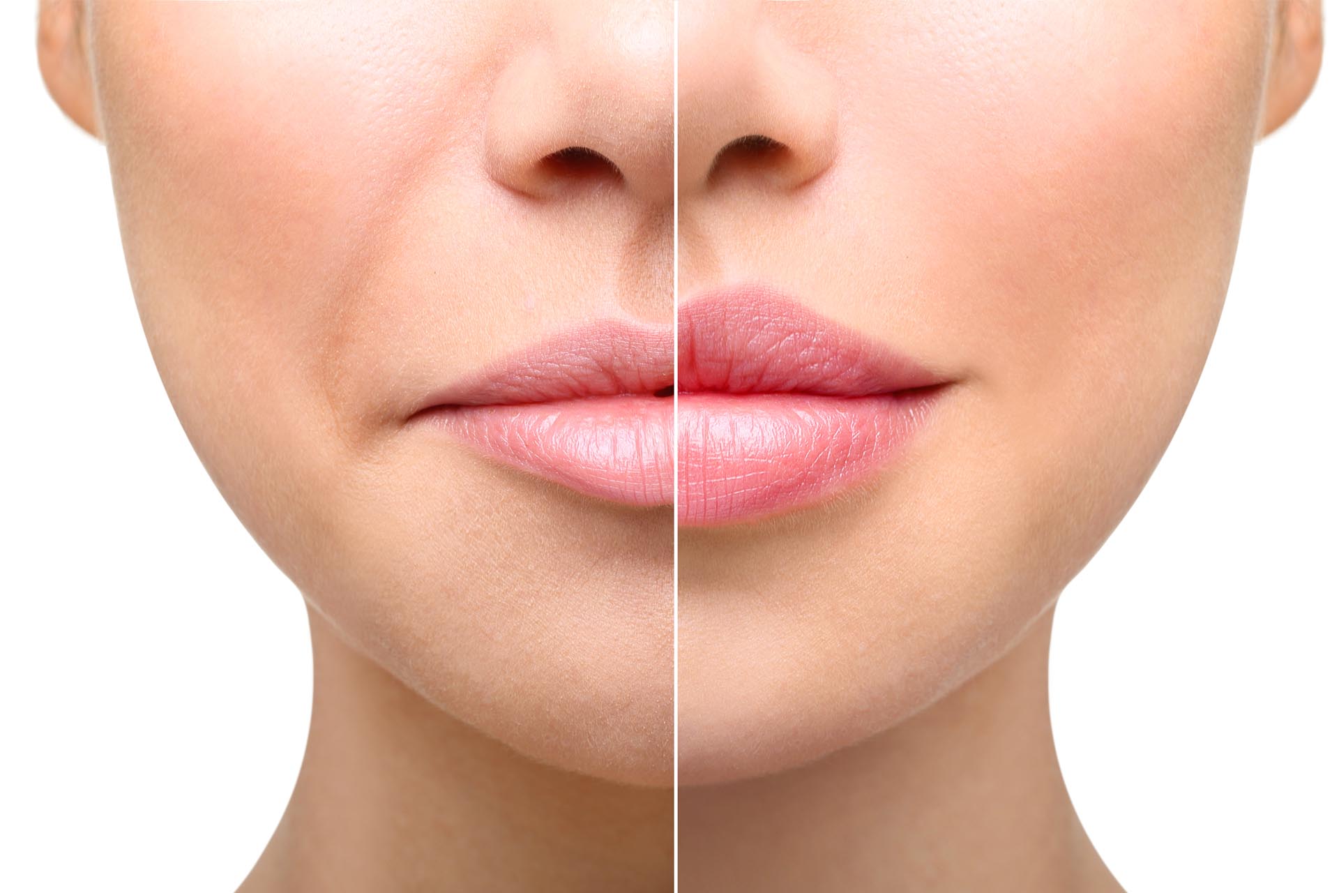 Face Filler