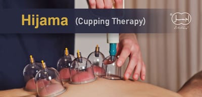 What You Need To Know About Hijama Cupping