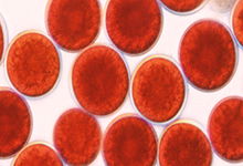 Natural Anti-oxidant----Astaxanthin