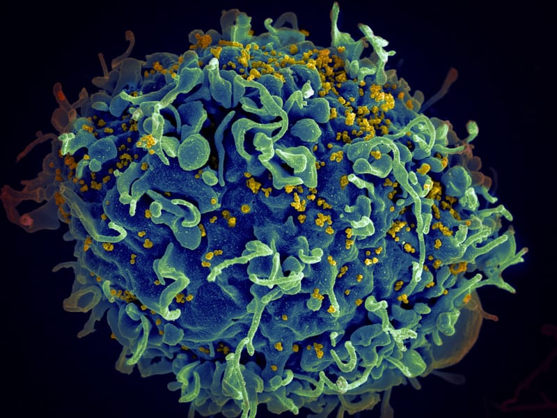 Combination anti-HIV antibody infusions suppress virus for prolonged period