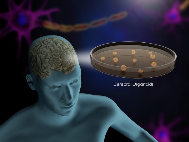 Brain Organoids and Assembloids: Novel Models for Understanding and Treating Neurodevelopmental Disorders