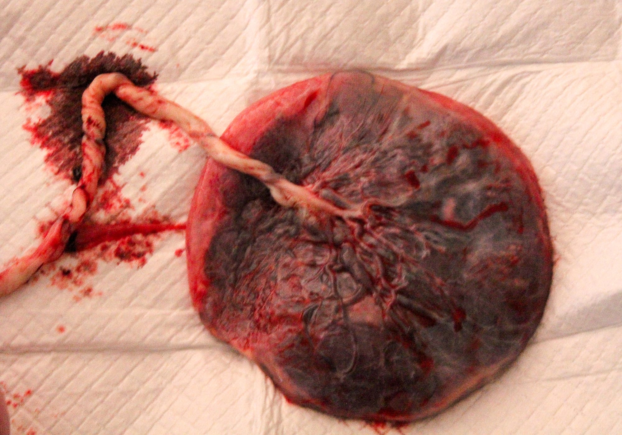 At Home // Waterbirth