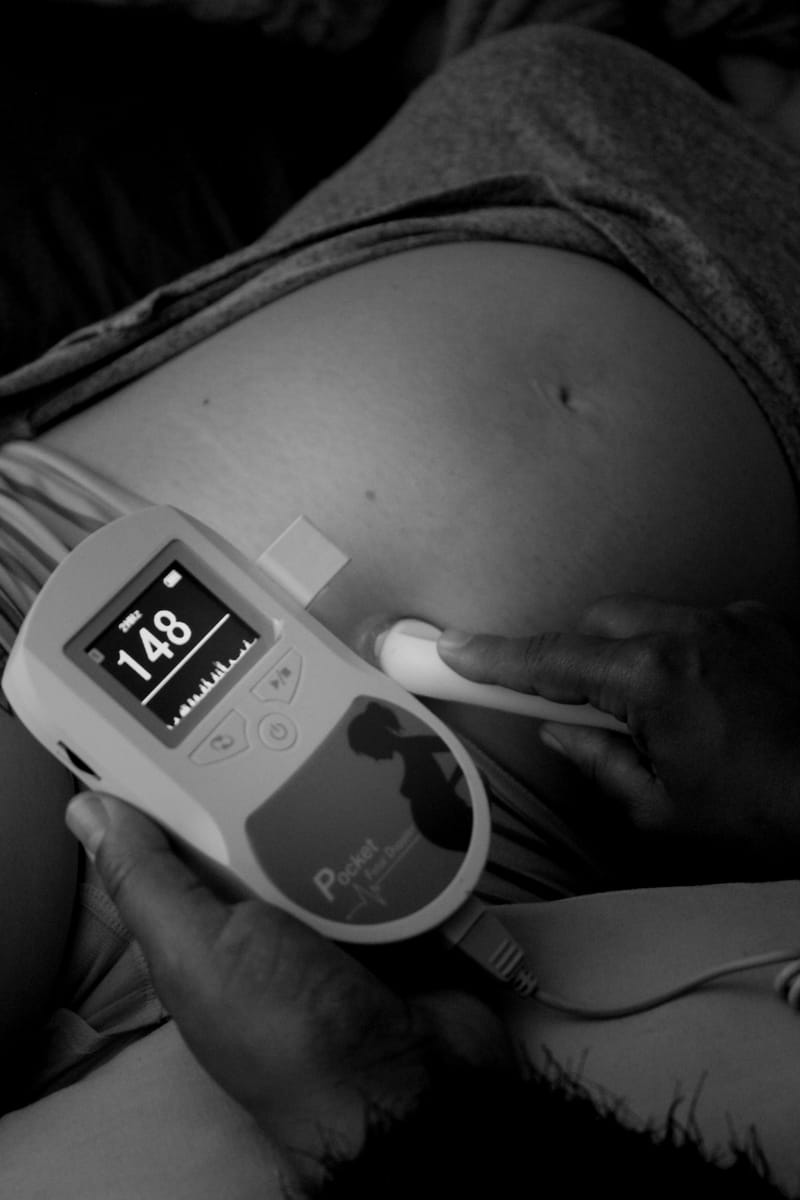 I Run A Successful Birth Photography Business