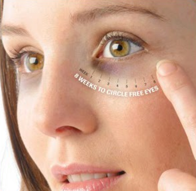 All Natural Dark Circles Treatment That Works