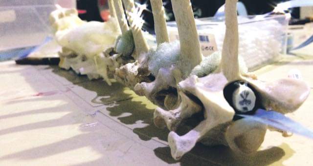 تجهيز اختراع دمية البزل في التخدير القطني