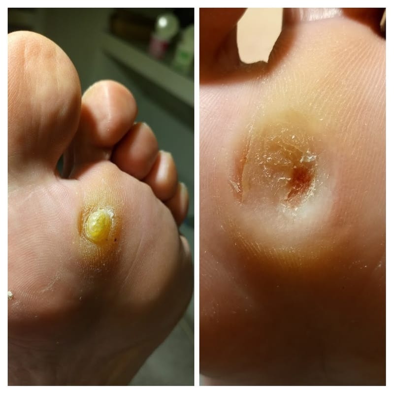 ΣΚΛΗΡΥΝΣΕΙΣ\ ΚΑΛΟΙ\ ΤΥΛΟΙ