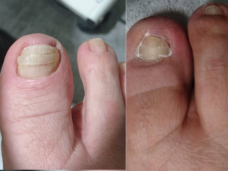 ΕΙΣΦΡΗΣΗ ΝΥΧΙΟΥ ΚΑΙ ΑΝΤΙΜΕΤΩΠΙΣΗ