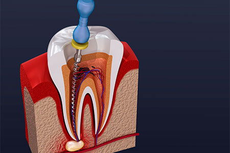 Endodontia