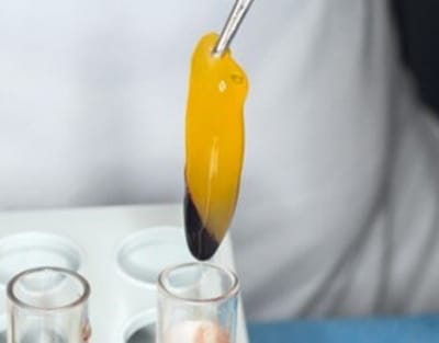 PRF - Platelet Rich Fibrin