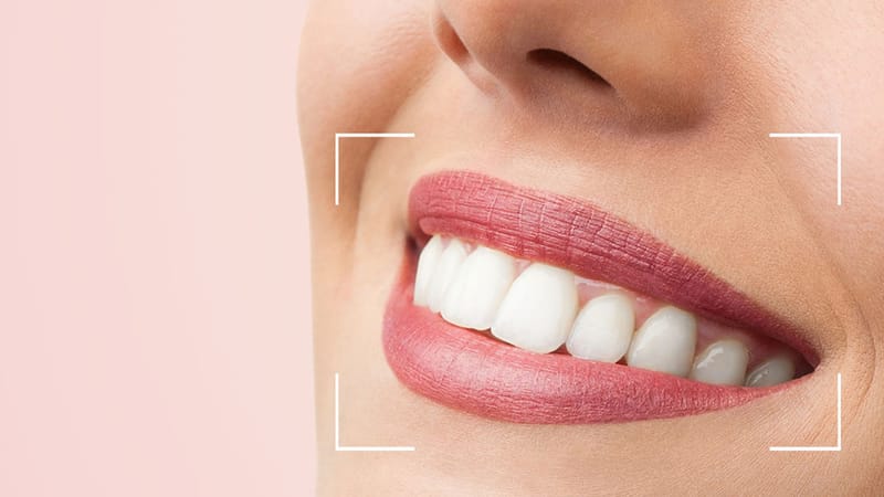 Odontologia Estética