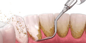 Periodontia