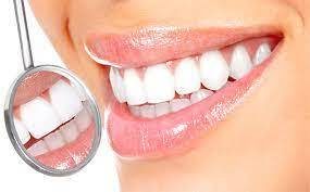 Clareamento Dental