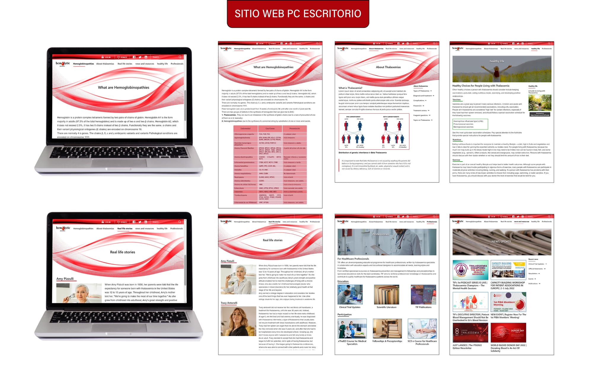 Sitio web en pc de escritorio para Anemias Hemolíticas congénitas (ha)