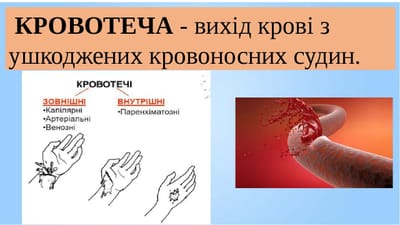 УРОК 7. КРОВОТЕЧА.  ШОКОВИЙ СТАН