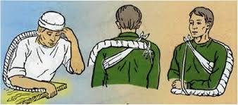 УРОК 8. РАНИ. ТРАВМИ. ІММОБІЛІЗАЦІЯ ПЕРЕЛОМІВ. ТРАНСПОРТУВАННЯ ПОСТРАЖДАЛИХ