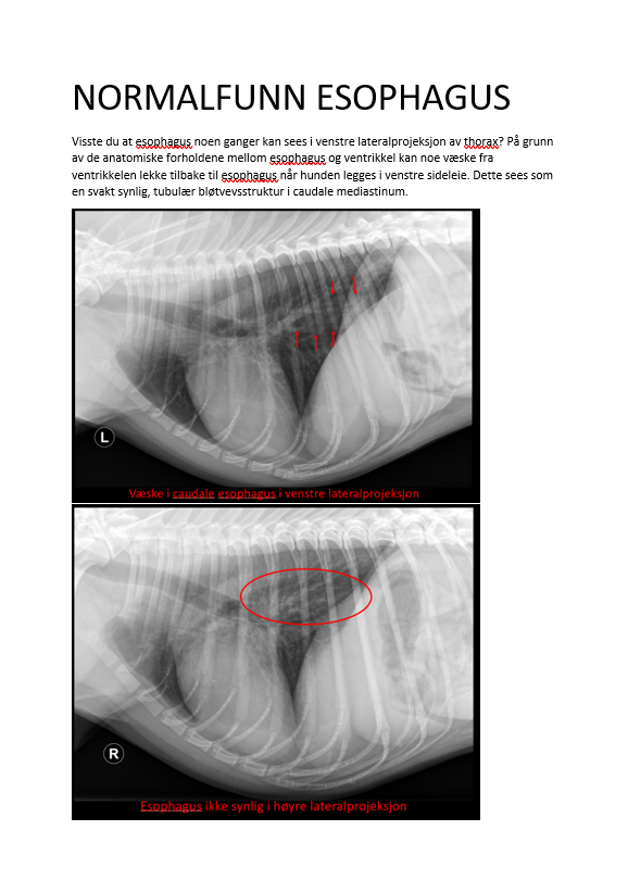 NORMALFUNN ESOPHAGUS