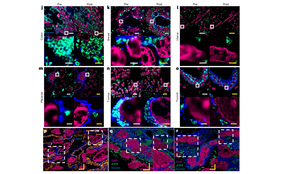 MMI Member Yongxin Zhao Publishes Manuscript on Expansion Microscopy in Nature Biotechnology, Jan. 02, 2023