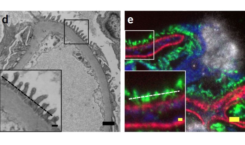 Nanoscale imaging of clinical specimens using pathology-optimized expansion microscopy