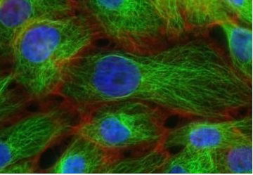 Research Grant: TE (UEFISCDI) PN-III-P1-1.1-TE-2019-1902, Romania (declined)